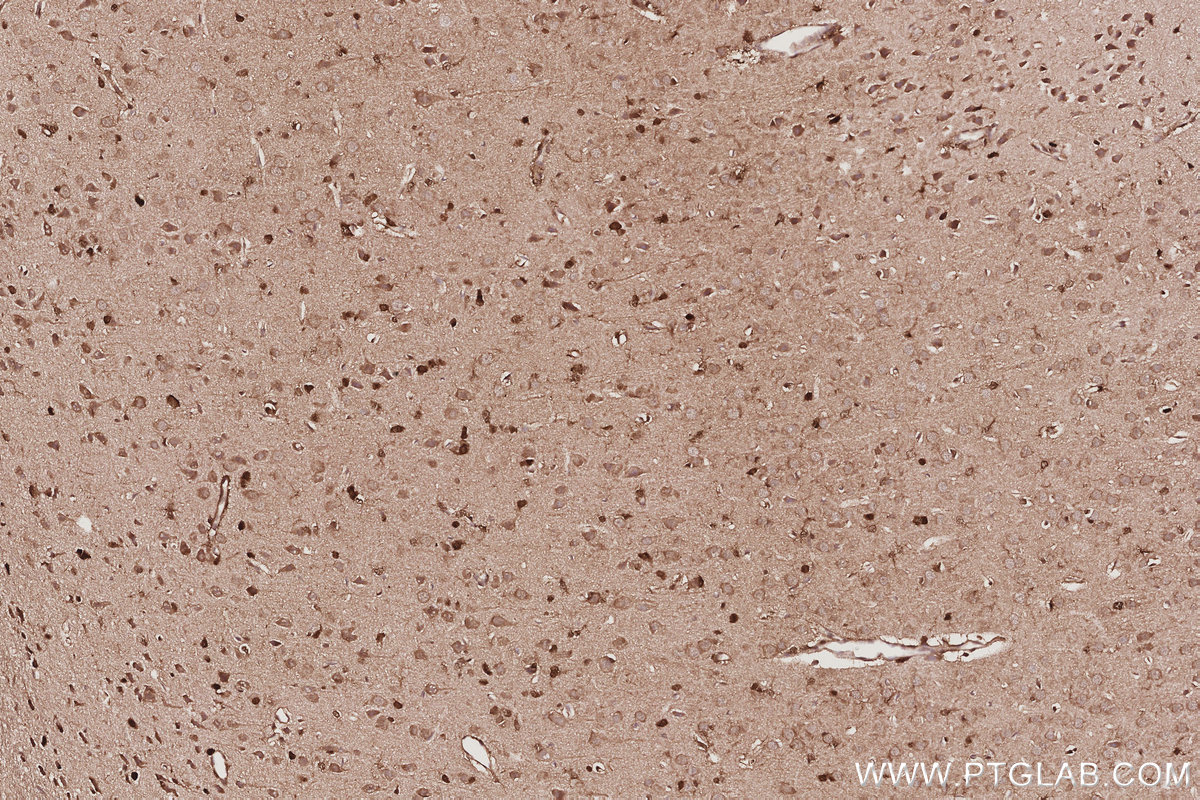 Immunohistochemical analysis of paraffin-embedded rat brain tissue slide using KHC3060 (SBDS IHC Kit). Immunohistochemical analysis of paraffin-embedded rat brain tissue slide using KHC3060 (SBDS IHC Kit).
