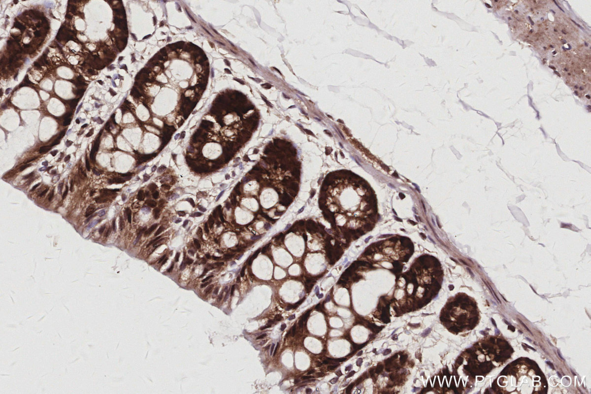 Immunohistochemical analysis of paraffin-embedded rat colon tissue slide using KHC3060 (SBDS IHC Kit). Immunohistochemical analysis of paraffin-embedded rat colon tissue slide using KHC3060 (SBDS IHC Kit).