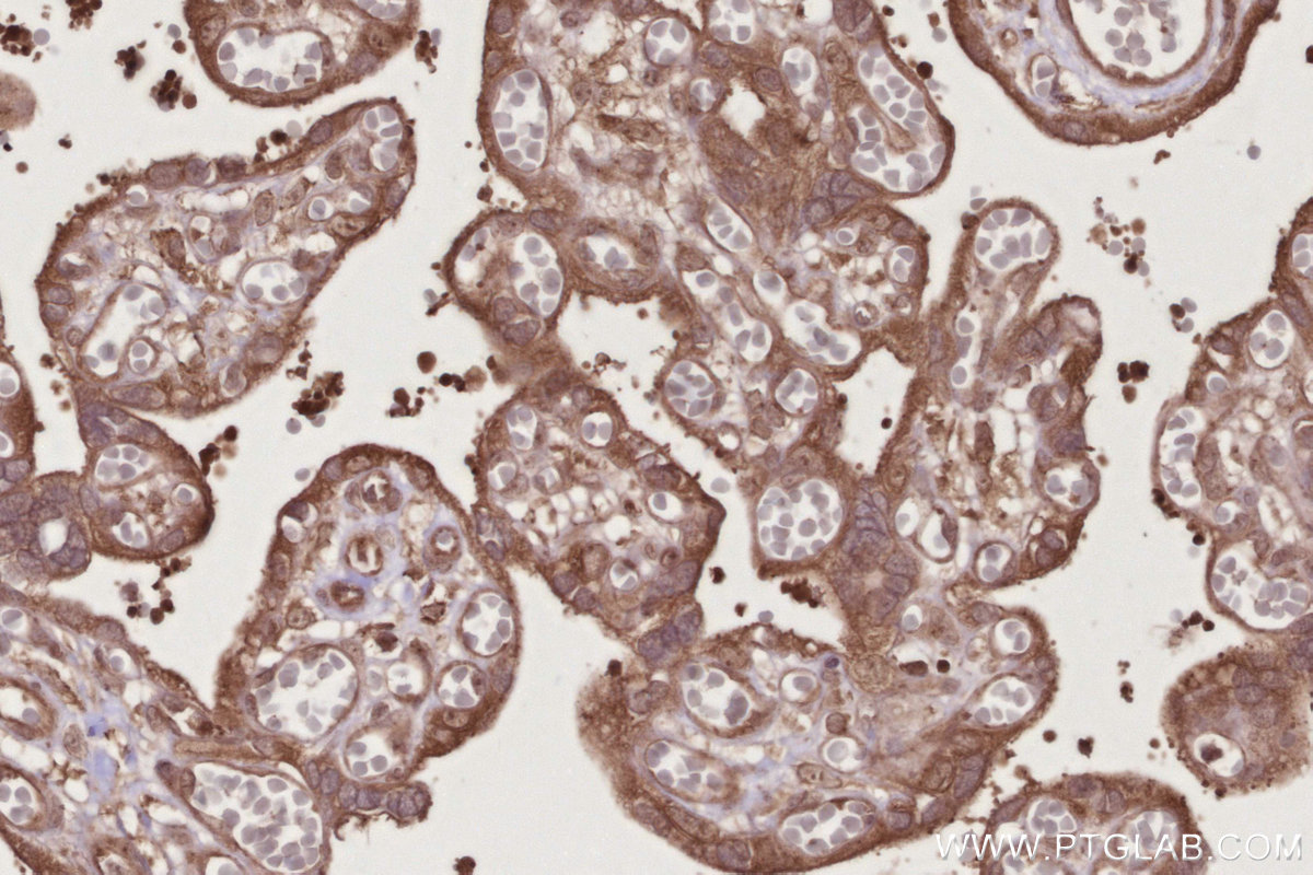 Immunohistochemical analysis of paraffin-embedded human placenta tissue slide using KHC2736 (SCFD1 IHC Kit).