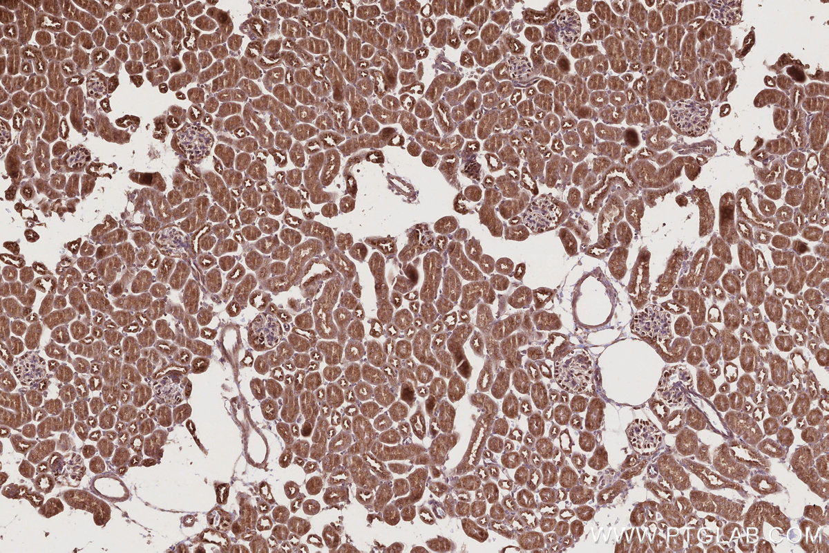 Immunohistochemical analysis of paraffin-embedded mouse kidney tissue slide using KHC2736 (SCFD1 IHC Kit).