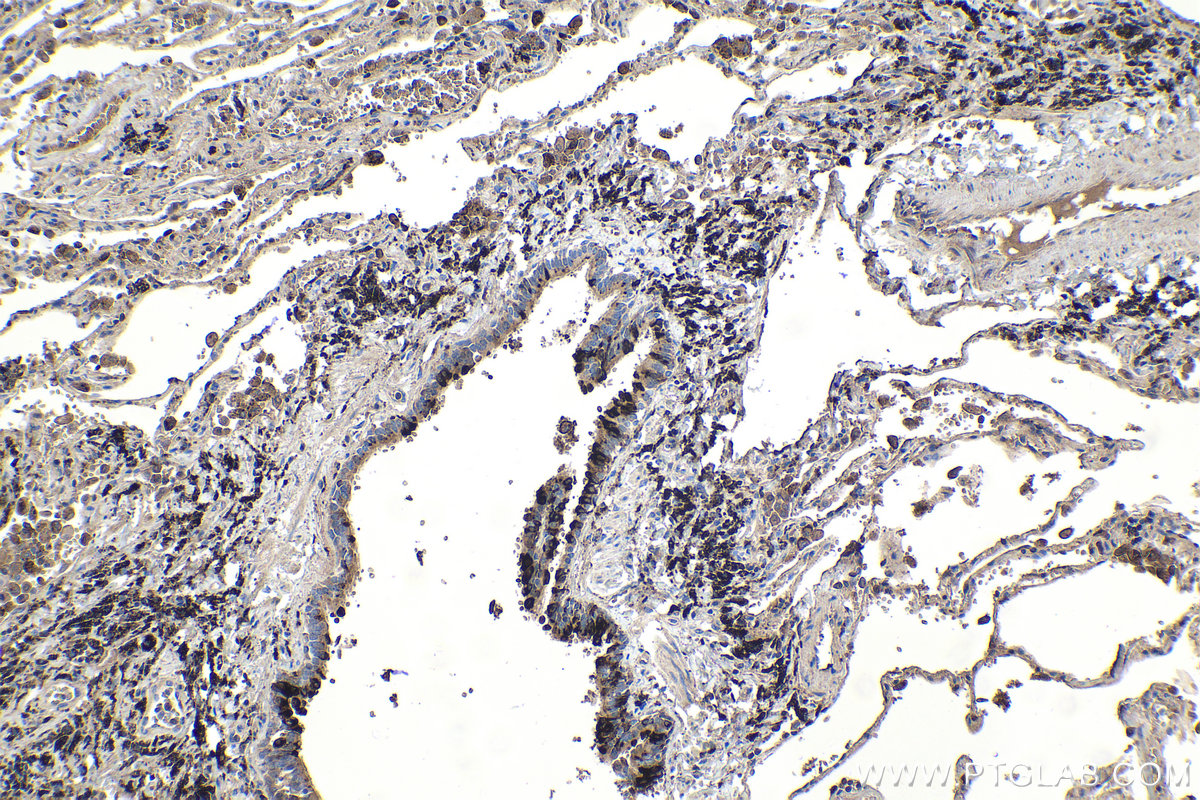 Immunohistochemical analysis of paraffin-embedded human lung tissue slide using KHC1092 (SCGB3A2 IHC Kit).