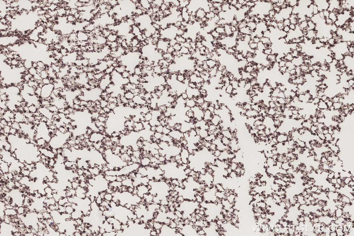 Immunohistochemical analysis of paraffin-embedded mouse lung tissue slide using KHC3198 (SCP2/SCPx IHC Kit).