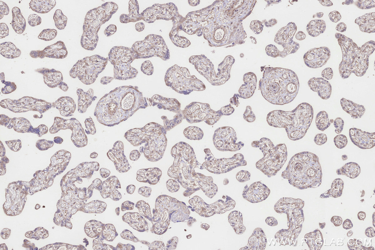 Immunohistochemical analysis of paraffin-embedded human placenta tissue slide using KHC3198 (SCP2/SCPx IHC Kit).