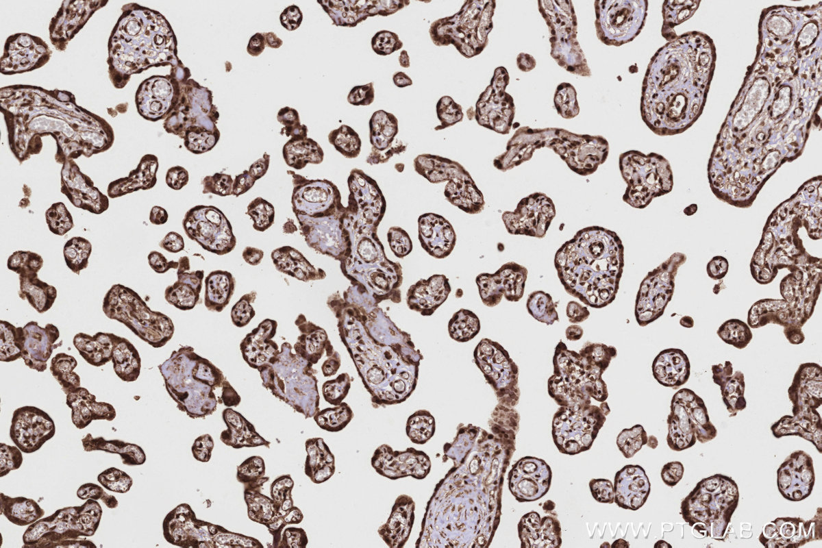 Immunohistochemical analysis of paraffin-embedded human placenta tissue slide using KHC2803 (SCYL1 IHC Kit).