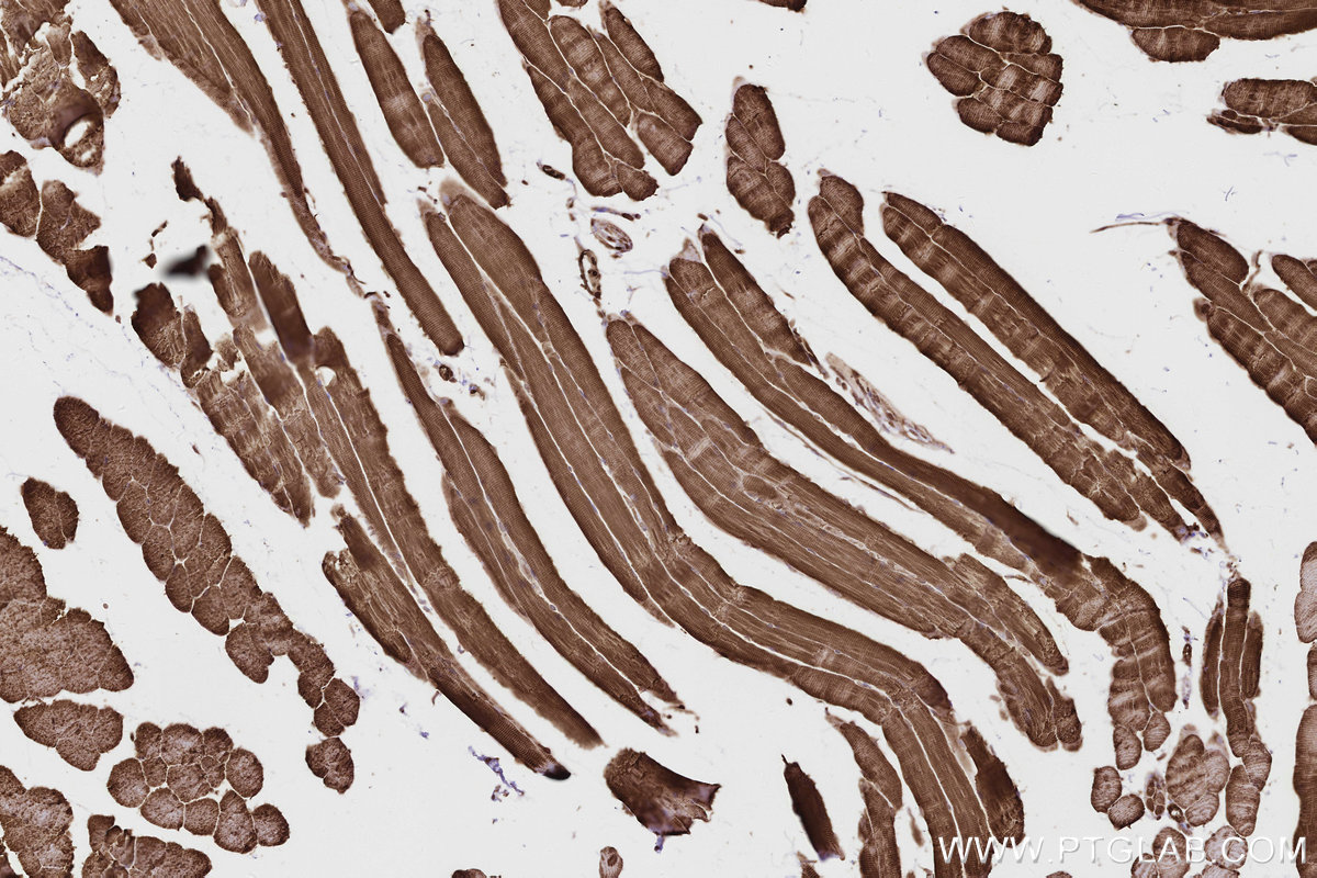Immunohistochemical analysis of paraffin-embedded mouse skeletal muscle tissue slide using KHC2803 (SCYL1 IHC Kit).