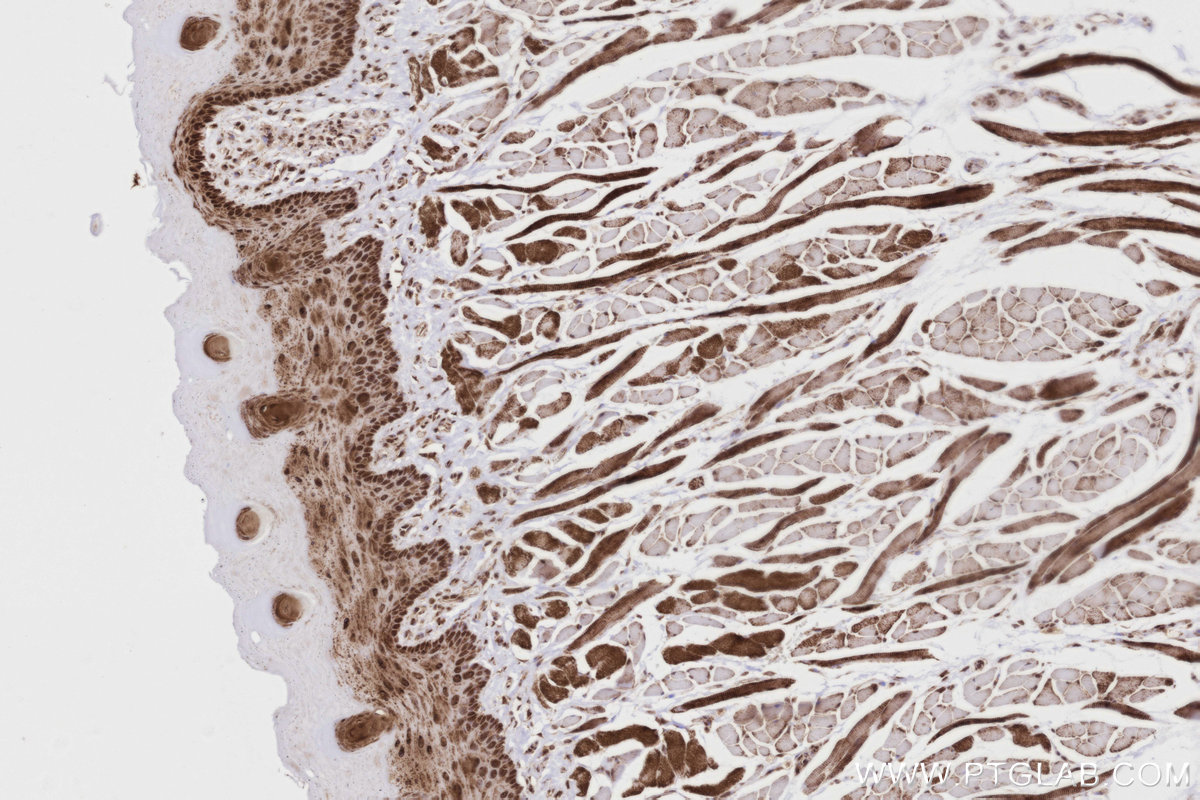 Immunohistochemical analysis of paraffin-embedded rat tongue tissue slide using KHC2803 (SCYL1 IHC Kit).
