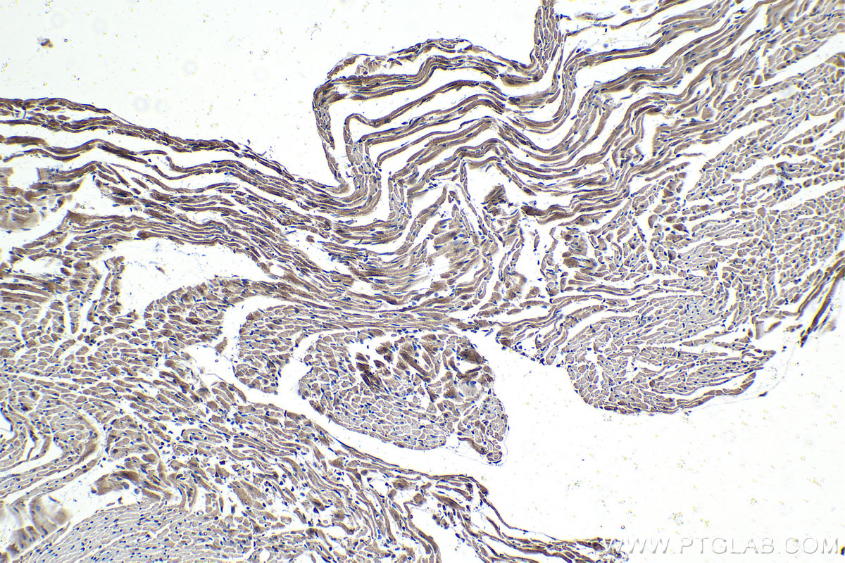 Immunohistochemical analysis of paraffin-embedded mouse heart tissue slide using KHC1423 (SDCBP IHC Kit).