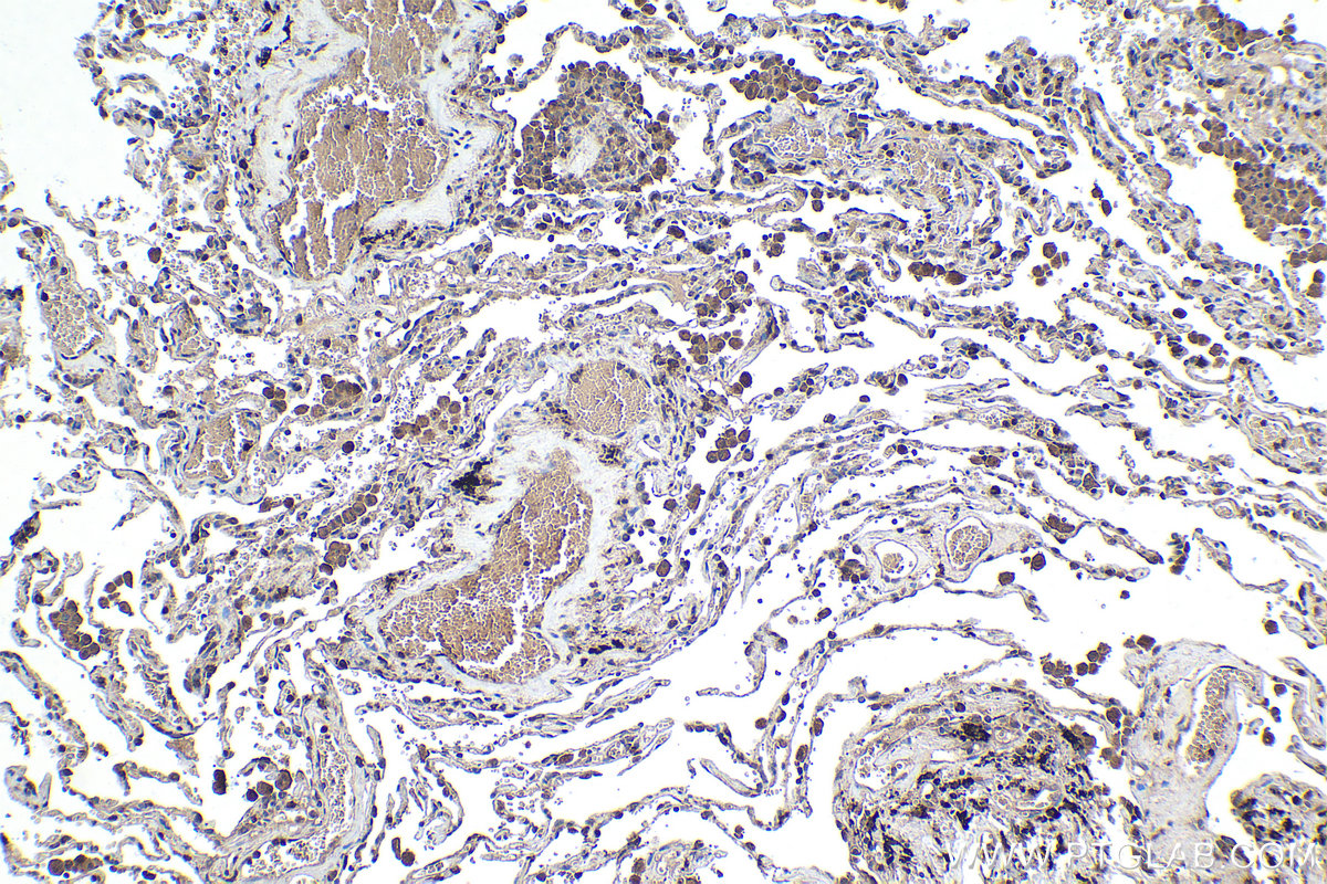 Immunohistochemical analysis of paraffin-embedded human lung tissue slide using KHC1423 (SDCBP IHC Kit).