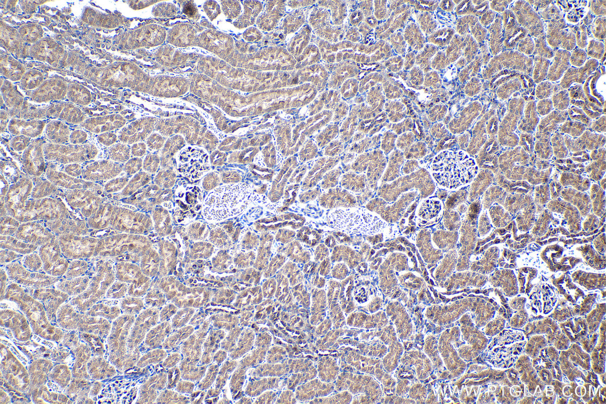 Immunohistochemical analysis of paraffin-embedded rat kidney tissue slide using KHC1250 (SDF4 IHC Kit).