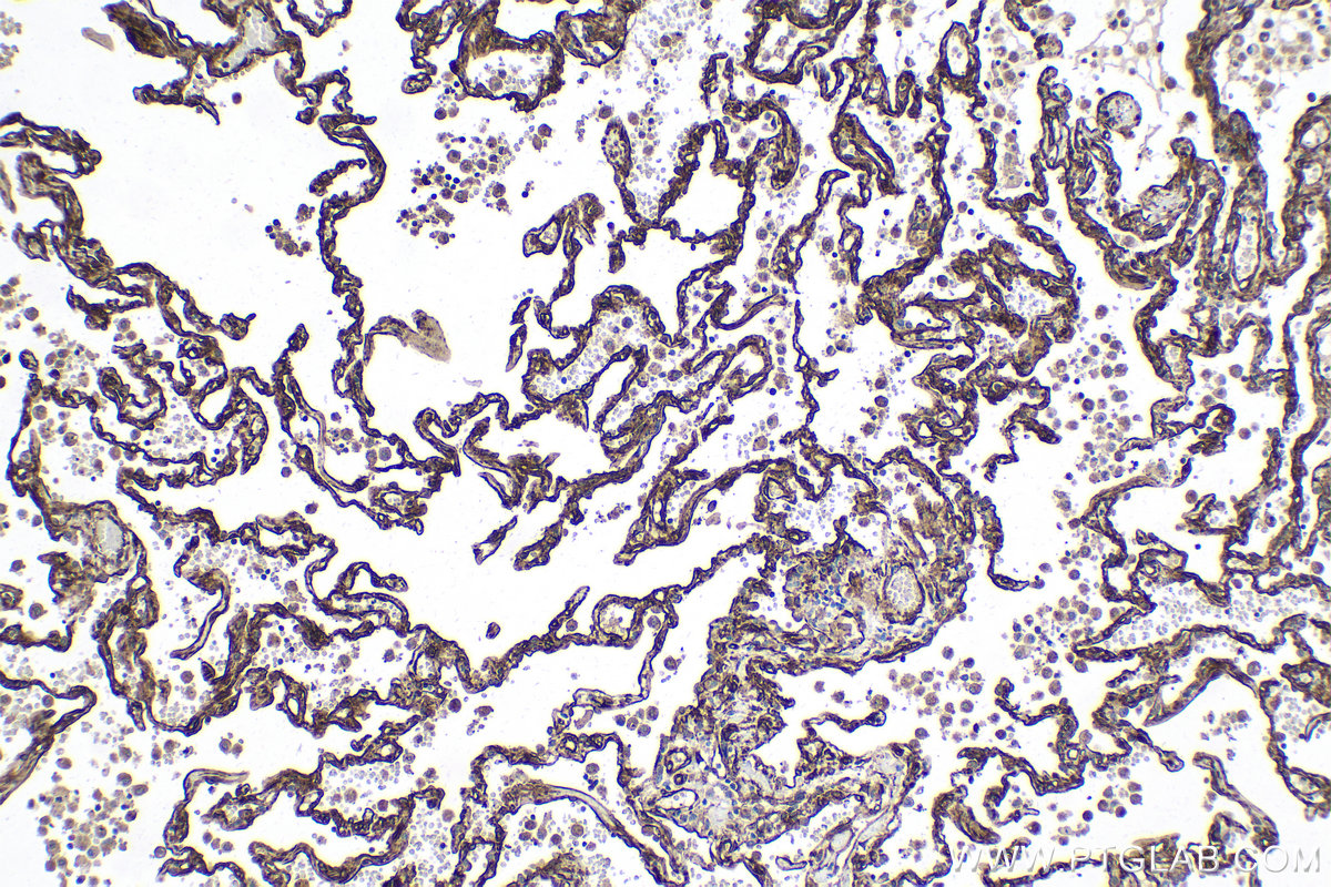 Immunohistochemical analysis of paraffin-embedded human lung tissue slide using KHC2147 (SDPR IHC Kit).