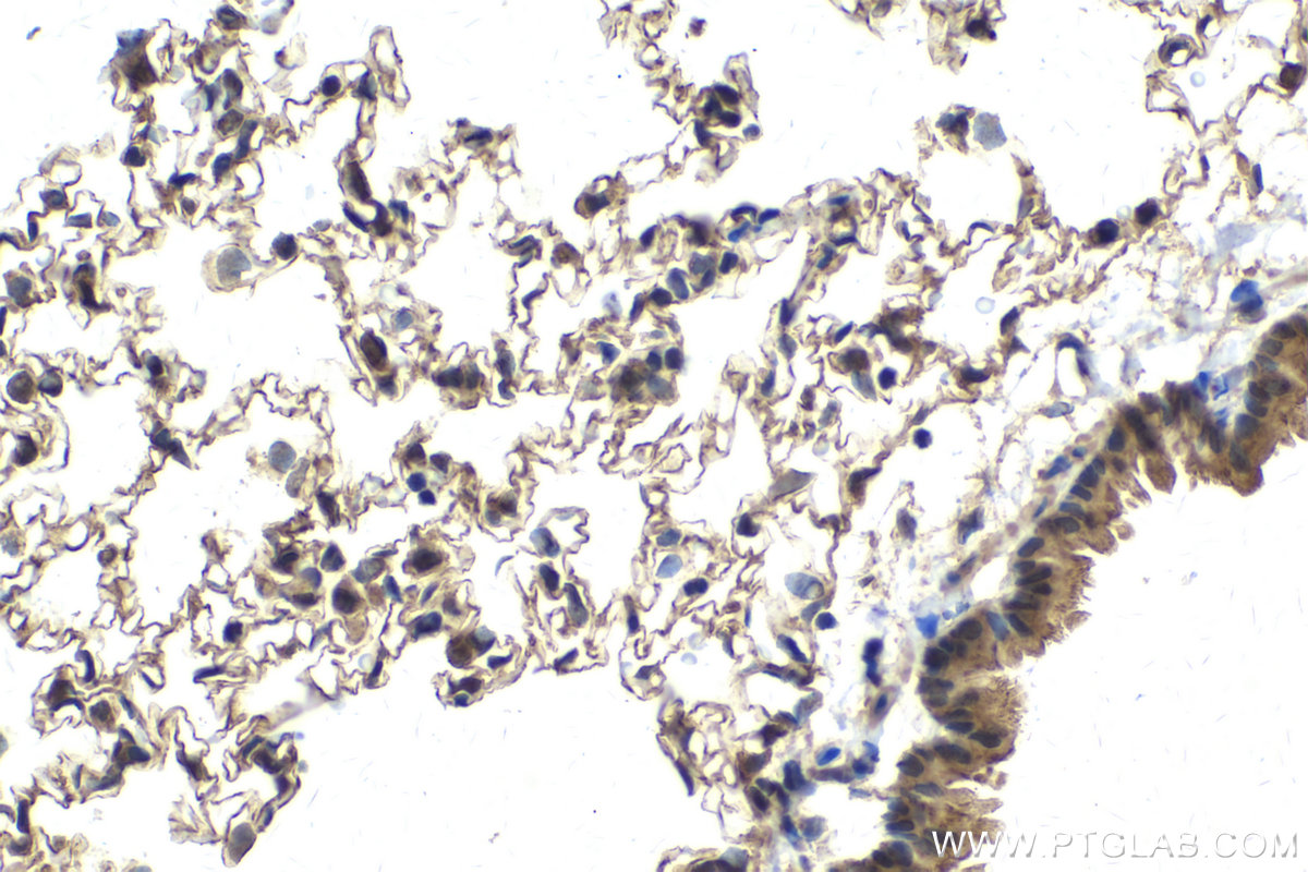 Immunohistochemical analysis of paraffin-embedded rat lung tissue slide using KHC2147 (SDPR IHC Kit).