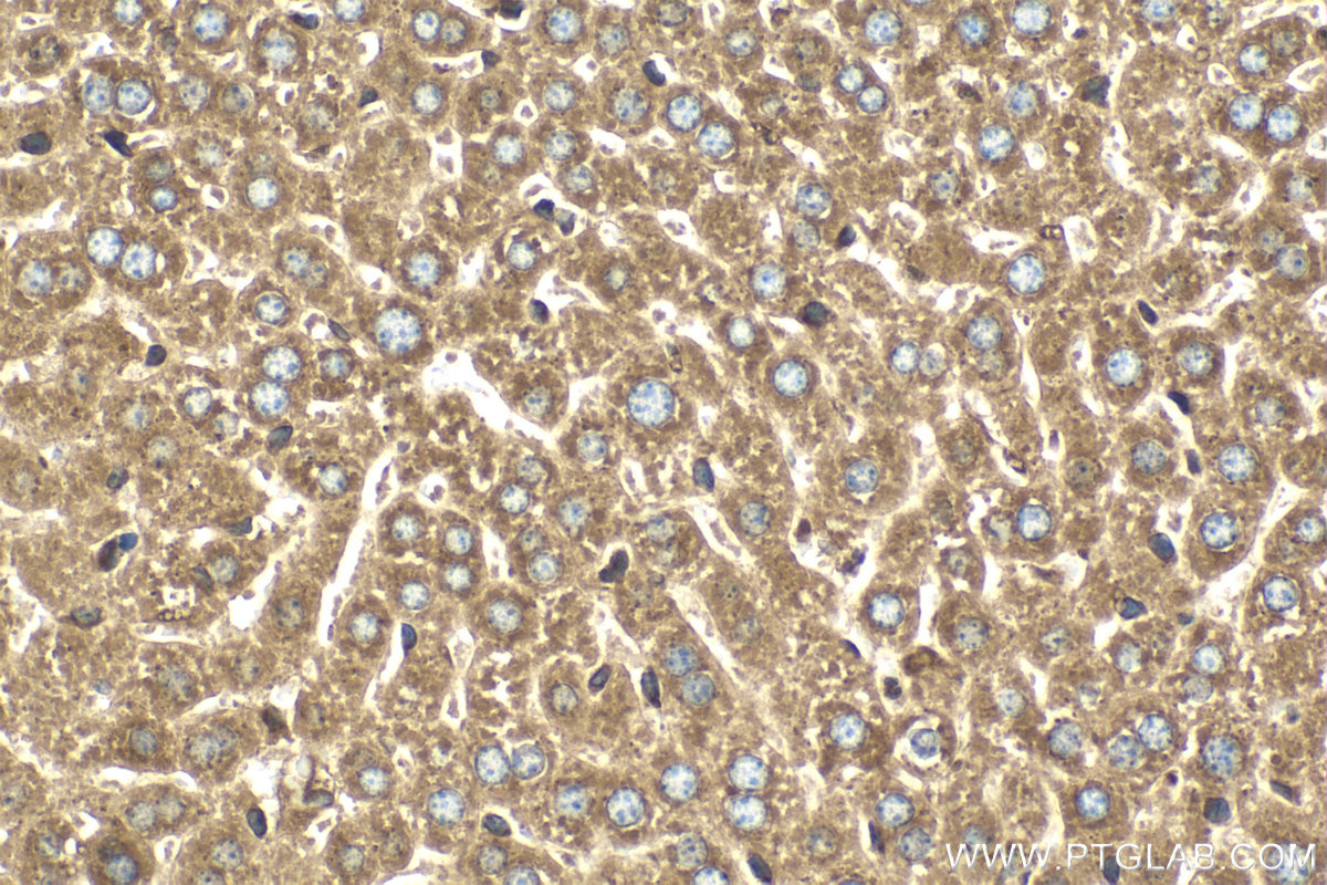 Immunohistochemical analysis of paraffin-embedded mouse liver tissue slide using KHC2112 (SEC22B IHC Kit).