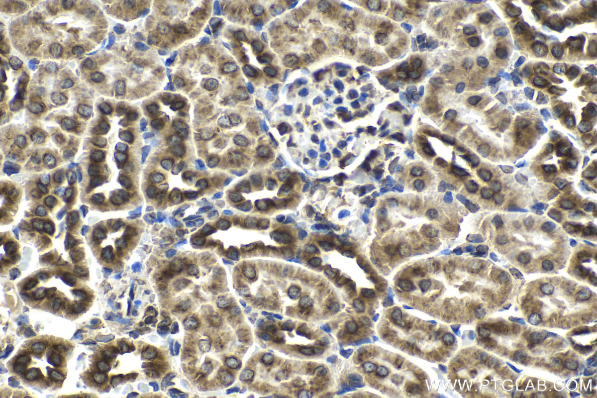 Immunohistochemical analysis of paraffin-embedded rat kidney tissue slide using KHC2112 (SEC22B IHC Kit).