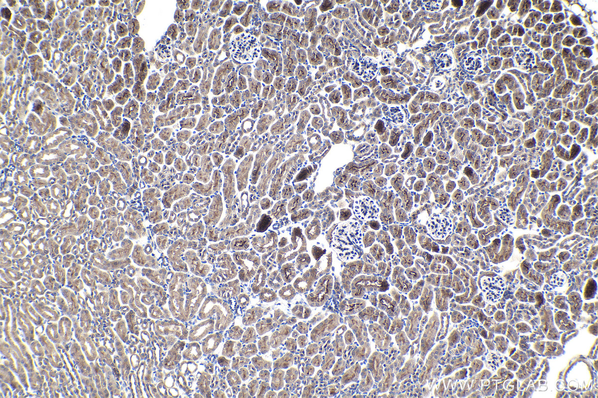 Immunohistochemical analysis of paraffin-embedded mouse kidney tissue slide using KHC0994 (SEC24C IHC Kit).