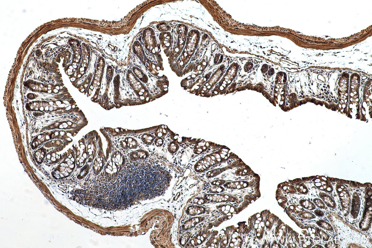 Immunohistochemical analysis of paraffin-embedded mouse colon tissue slide using KHC0703 (SEC31A IHC Kit).