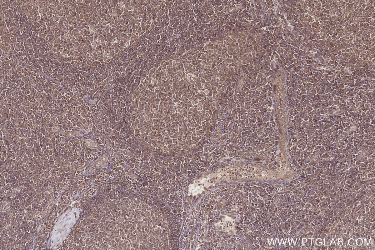 Immunohistochemical analysis of paraffin-embedded human tonsillitis tissue slide using KHC2789 (SEH1L IHC Kit). Immunohistochemical analysis of paraffin-embedded human tonsillitis tissue slide using KHC2789 (SEH1L IHC Kit).
