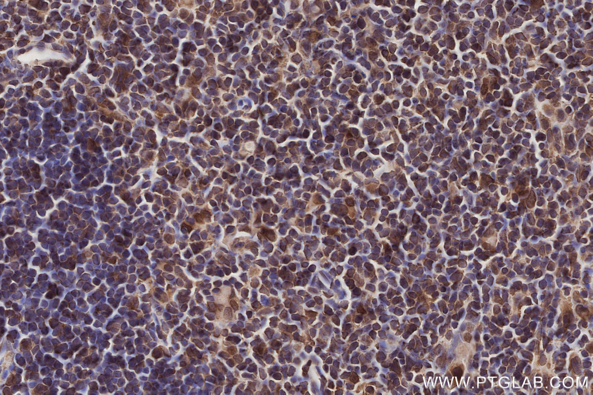 Immunohistochemical analysis of paraffin-embedded mouse thymus tissue slide using KHC2789 (SEH1L IHC Kit). Immunohistochemical analysis of paraffin-embedded mouse thymus tissue slide using KHC2789 (SEH1L IHC Kit).