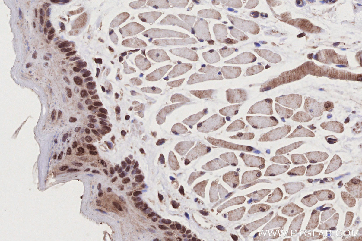 Immunohistochemical analysis of paraffin-embedded mouse tongue tissue slide using KHC2789 (SEH1L IHC Kit). Immunohistochemical analysis of paraffin-embedded mouse tongue tissue slide using KHC2789 (SEH1L IHC Kit).