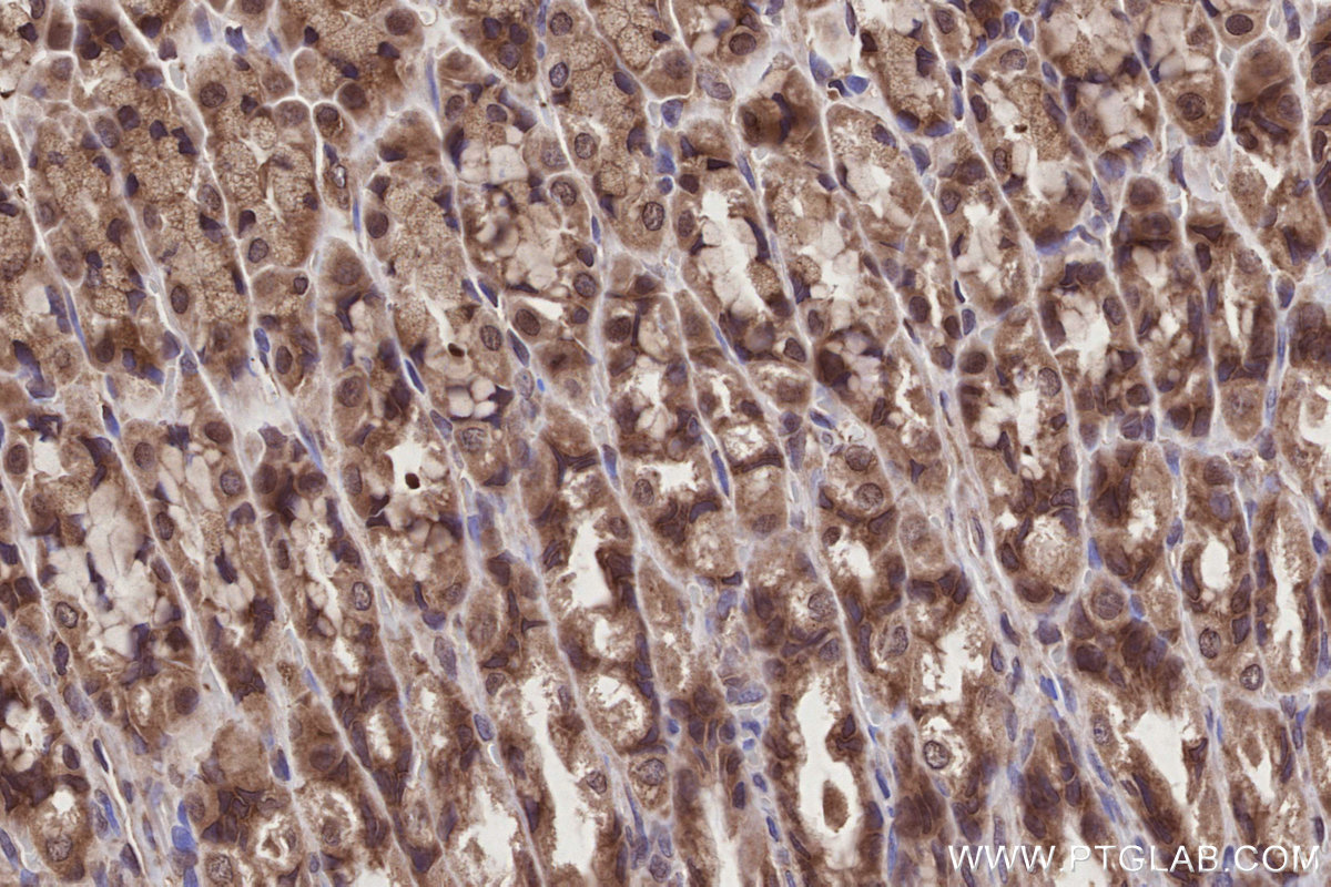 Immunohistochemical analysis of paraffin-embedded rat stomach tissue slide using KHC2789 (SEH1L IHC Kit). Immunohistochemical analysis of paraffin-embedded rat stomach tissue slide using KHC2789 (SEH1L IHC Kit).