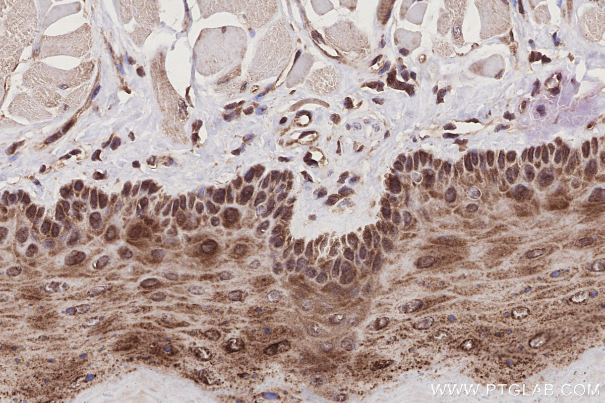 Immunohistochemical analysis of paraffin-embedded rat tongue tissue slide using KHC2789 (SEH1L IHC Kit). Immunohistochemical analysis of paraffin-embedded rat tongue tissue slide using KHC2789 (SEH1L IHC Kit).