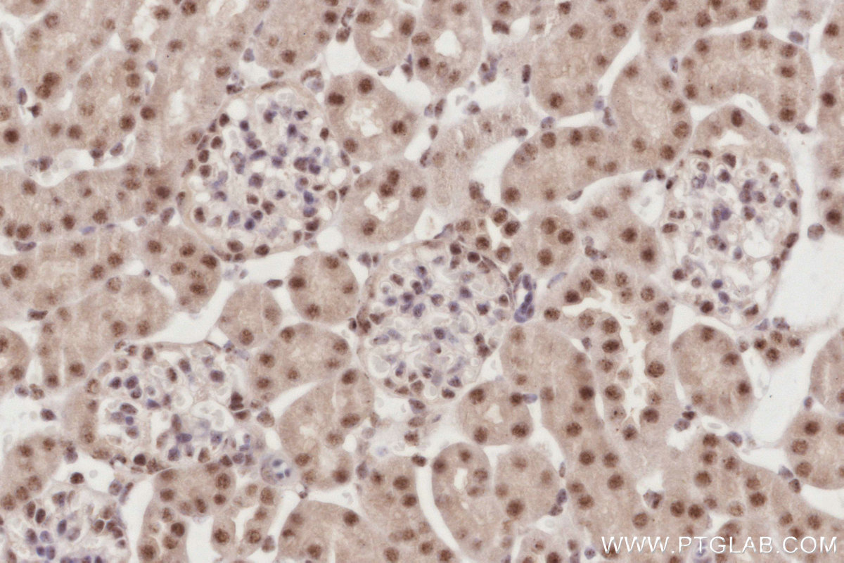 Immunohistochemical analysis of paraffin-embedded mouse kidney tissue slide using KHC2916 (SENP3 IHC Kit).