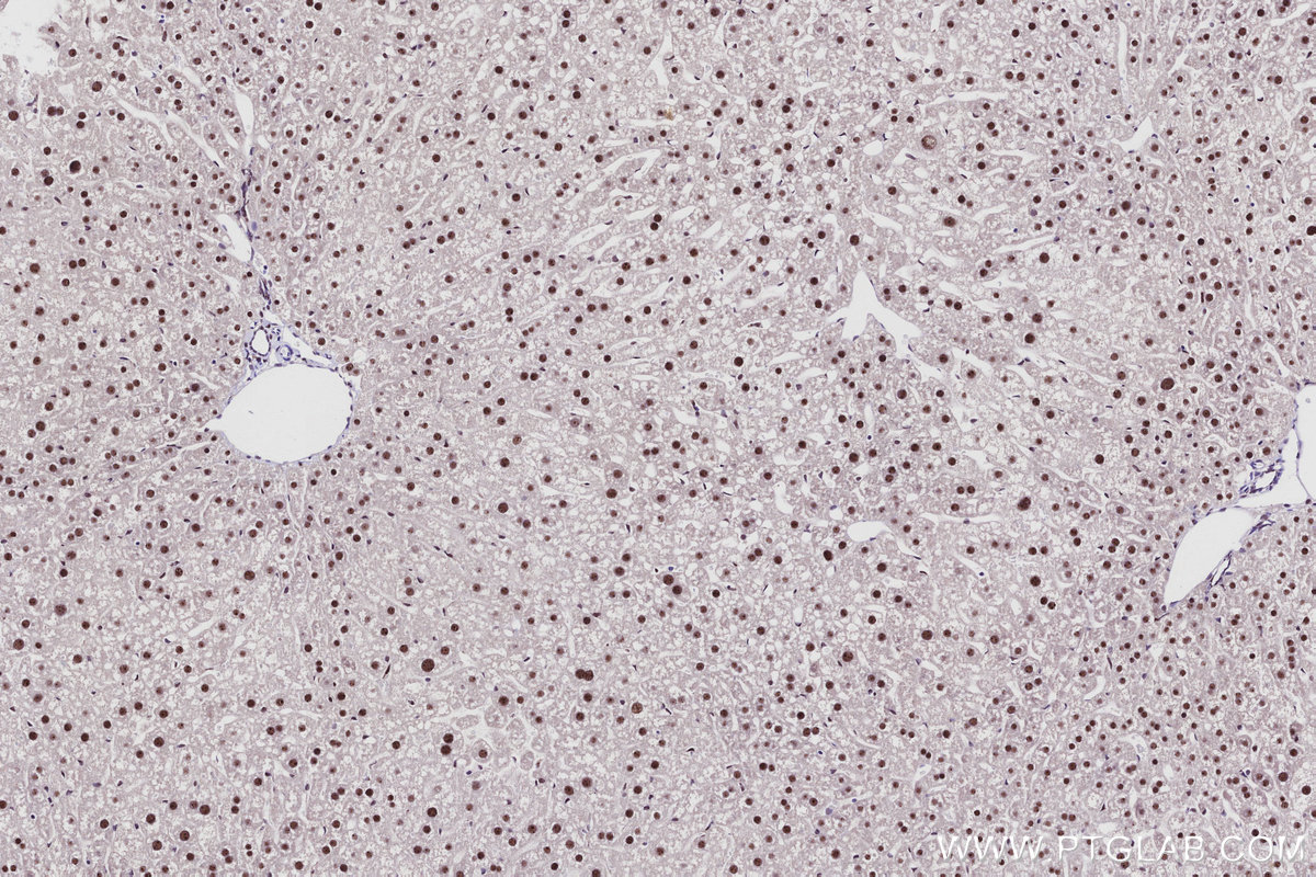 Immunohistochemical analysis of paraffin-embedded mouse liver tissue slide using KHC2916 (SENP3 IHC Kit).