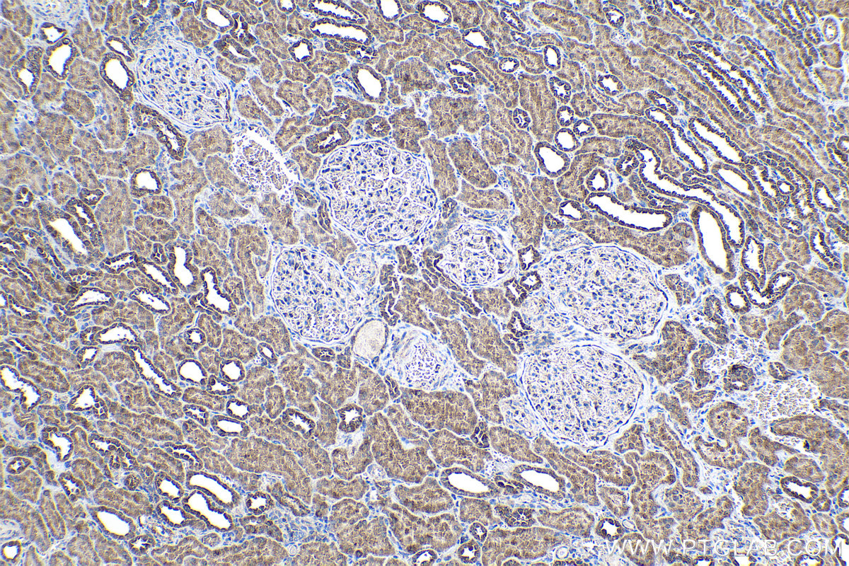 Immunohistochemical analysis of paraffin-embedded human kidney tissue slide using KHC1024 (SENP8 IHC Kit).