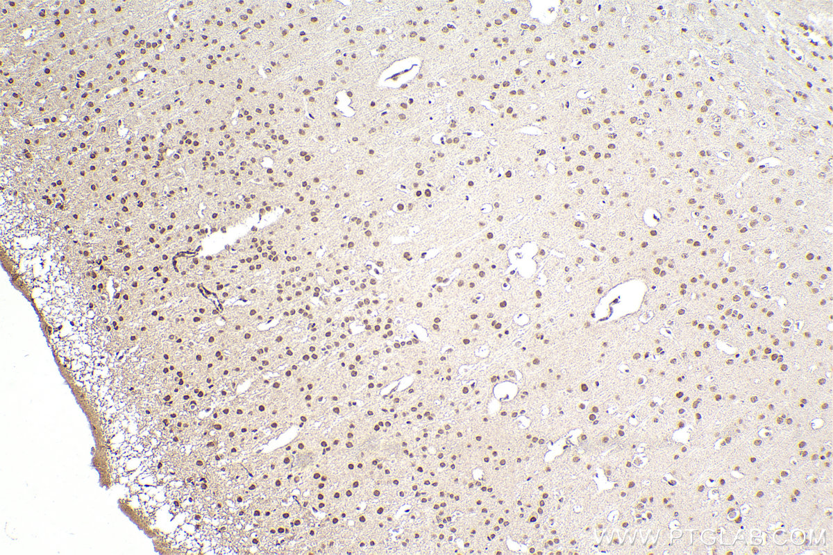 Immunohistochemical analysis of paraffin-embedded mouse brain tissue slide using KHC2293 (SEPHS1 IHC Kit).