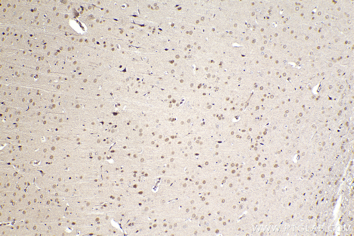 Immunohistochemical analysis of paraffin-embedded rat brain tissue slide using KHC2293 (SEPHS1 IHC Kit).