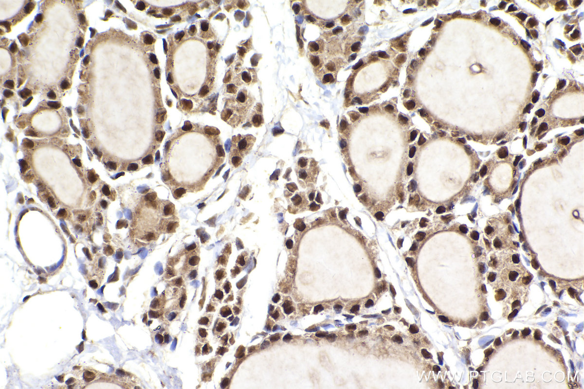 Immunohistochemical analysis of paraffin-embedded rat thyroid gland tissue slide using KHC2293 (SEPHS1 IHC Kit).