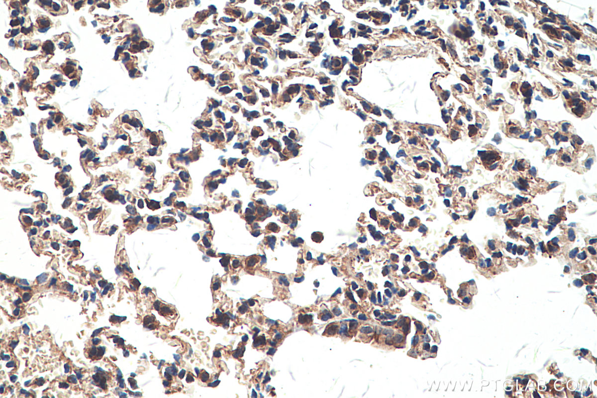 Immunohistochemical analysis of paraffin-embedded mouse lung tissue slide using KHC0322 (SEPN1 IHC Kit).
