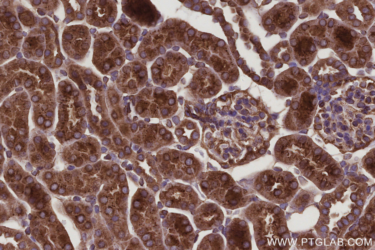 Immunohistochemical analysis of paraffin-embedded mouse kidney tissue slide using KHC2987 (SEPT10 IHC Kit).