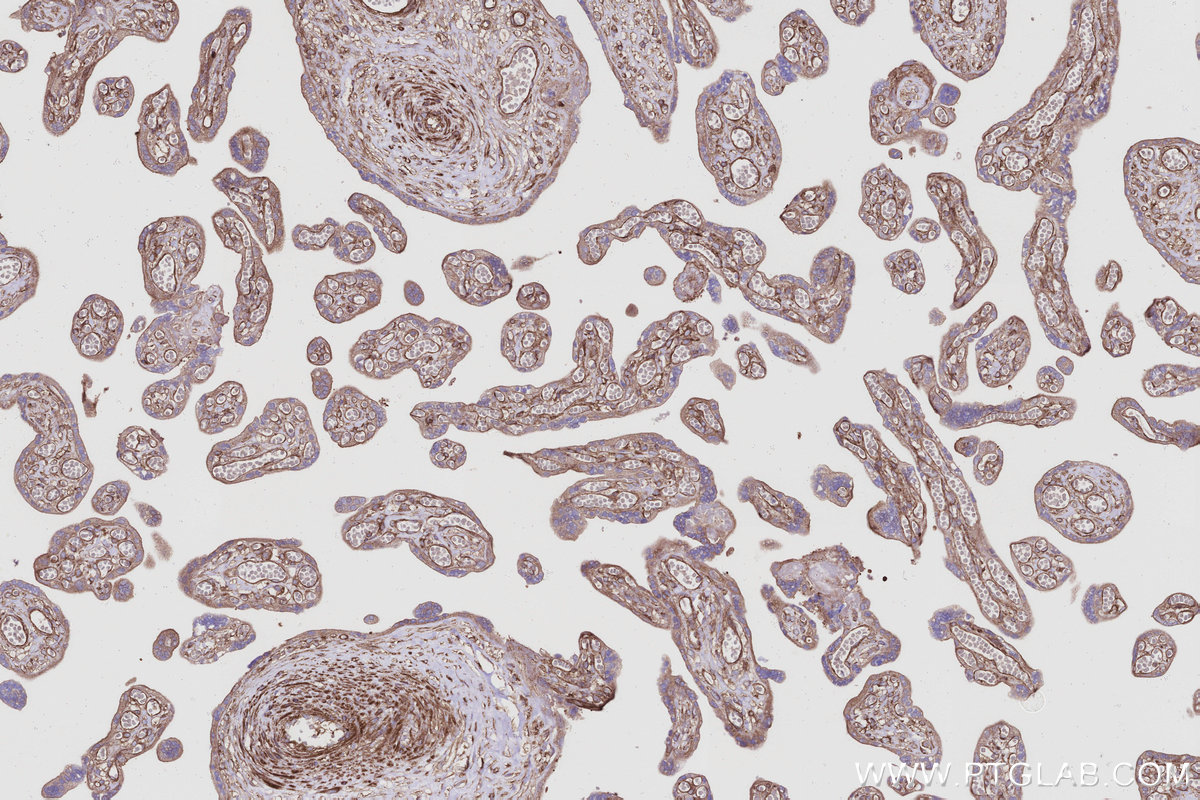 Immunohistochemical analysis of paraffin-embedded human placenta tissue slide using KHC2987 (SEPT10 IHC Kit).