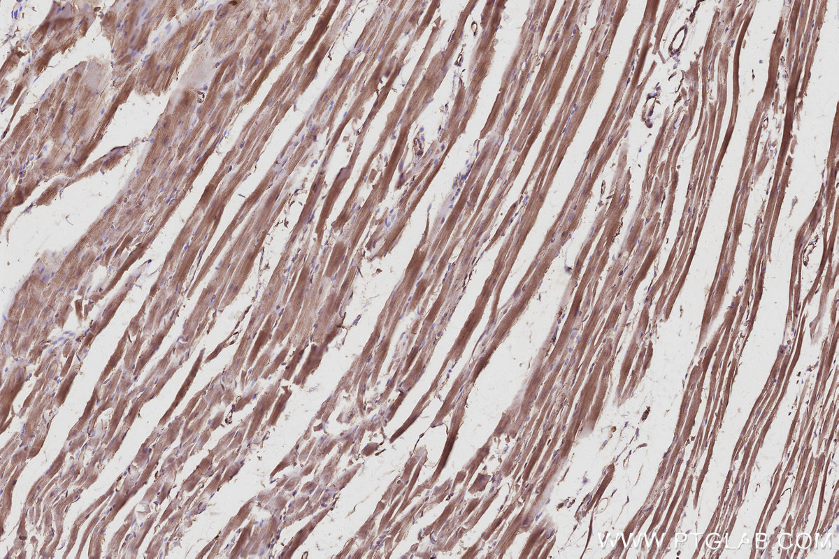 Immunohistochemical analysis of paraffin-embedded rat heart tissue slide using KHC2987 (SEPT10 IHC Kit).