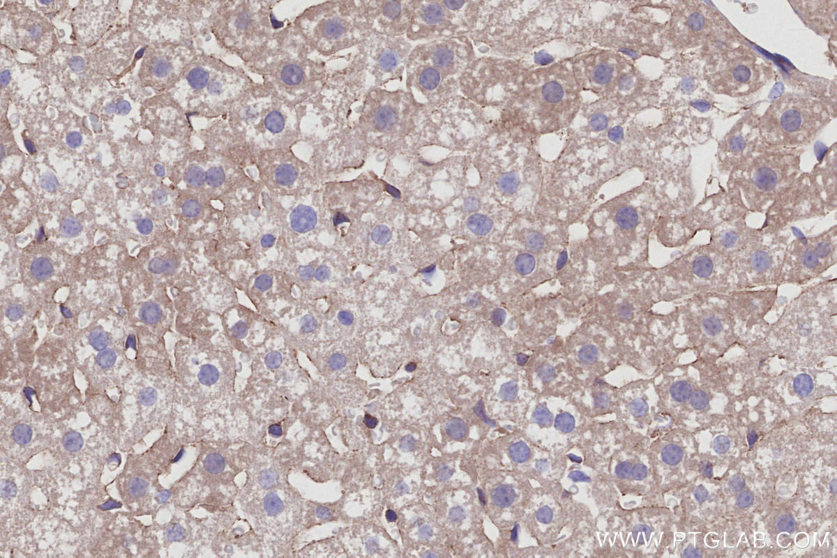 Immunohistochemical analysis of paraffin-embedded mouse liver tissue slide using KHC2957 (SEPT11 IHC Kit). Immunohistochemical analysis of paraffin-embedded mouse liver tissue slide using KHC2957 (SEPT11 IHC Kit).