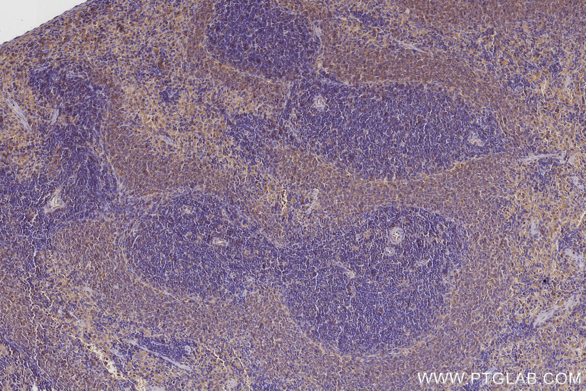 Immunohistochemical analysis of paraffin-embedded rat spleen tissue slide using KHC2957 (SEPT11 IHC Kit). Immunohistochemical analysis of paraffin-embedded rat spleen tissue slide using KHC2957 (SEPT11 IHC Kit).