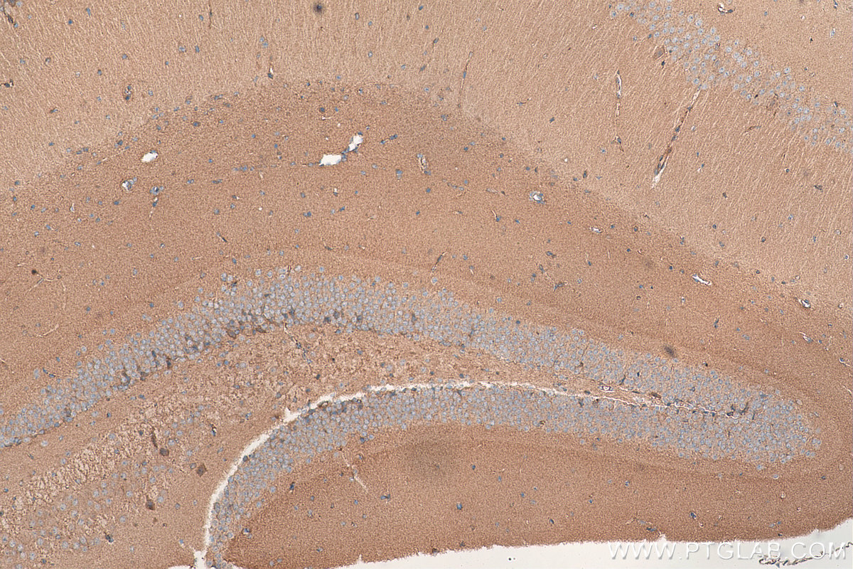 Immunohistochemical analysis of paraffin-embedded mouse brain tissue slide using KHC0995 (SEPT7 IHC Kit).