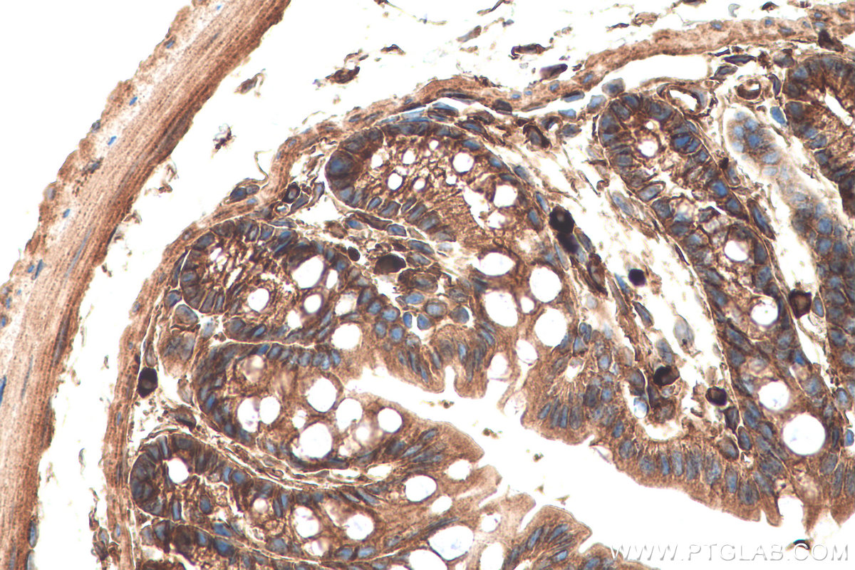 Immunohistochemical analysis of paraffin-embedded mouse colon tissue slide using KHC0726 (SEPTIN2 IHC Kit).