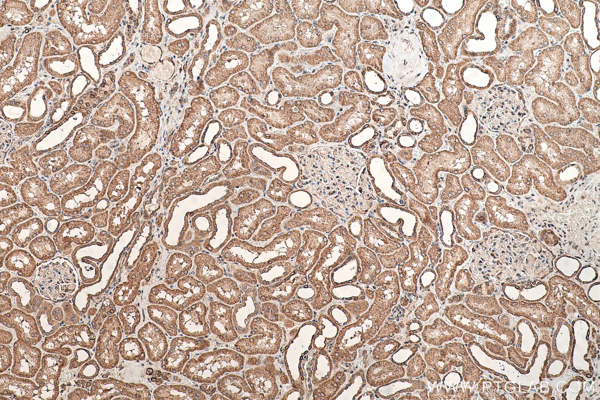 Immunohistochemical analysis of paraffin-embedded human kidney tissue slide using KHC0738 (SEPTIN9 IHC Kit).