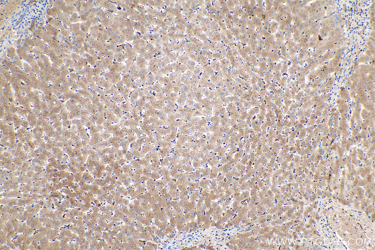 Immunohistochemical analysis of paraffin-embedded human liver tissue slide using KHC0458 (Alpha Antichymotrypsin IHC Kit).