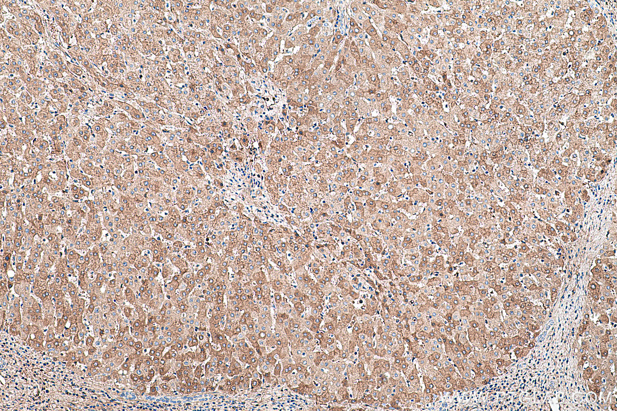 Immunohistochemical analysis of paraffin-embedded human liver tissue slide using KHC0460 (SERPINC1 IHC Kit).