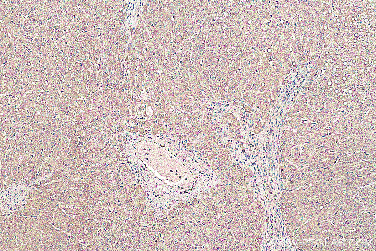 Immunohistochemical analysis of paraffin-embedded human liver tissue slide using KHC0461 (SERPINE1 IHC Kit).