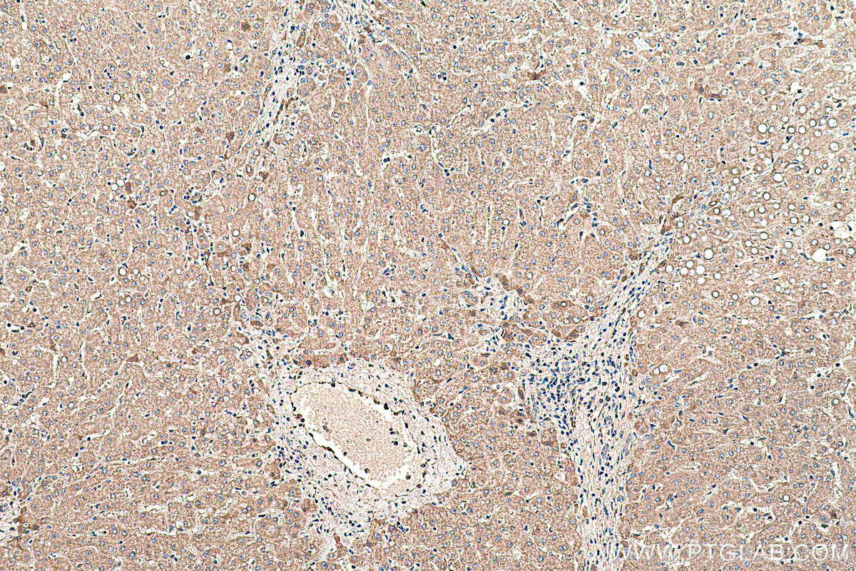 Immunohistochemical analysis of paraffin-embedded human liver tissue slide using KHC0462 (SERPINF1/PEDF IHC Kit).