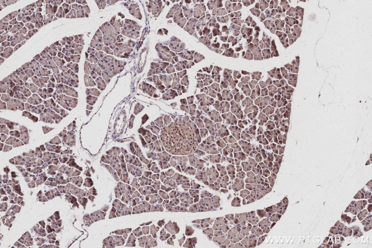 Immunohistochemical analysis of paraffin-embedded mouse pancreas tissue slide using KHC3011 (SERTAD1 IHC Kit).