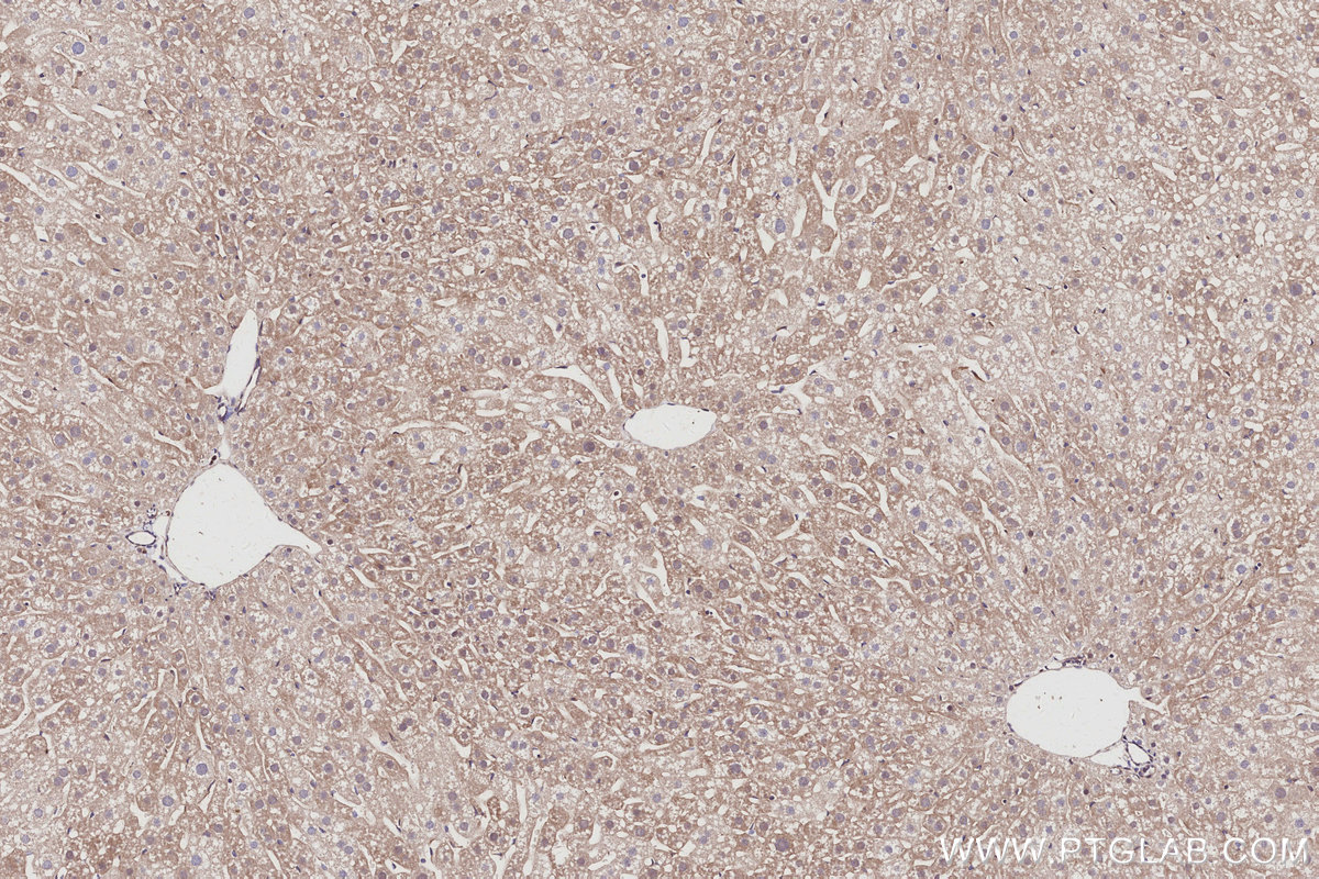 Immunohistochemical analysis of paraffin-embedded mouse liver tissue slide using KHC3011 (SERTAD1 IHC Kit).