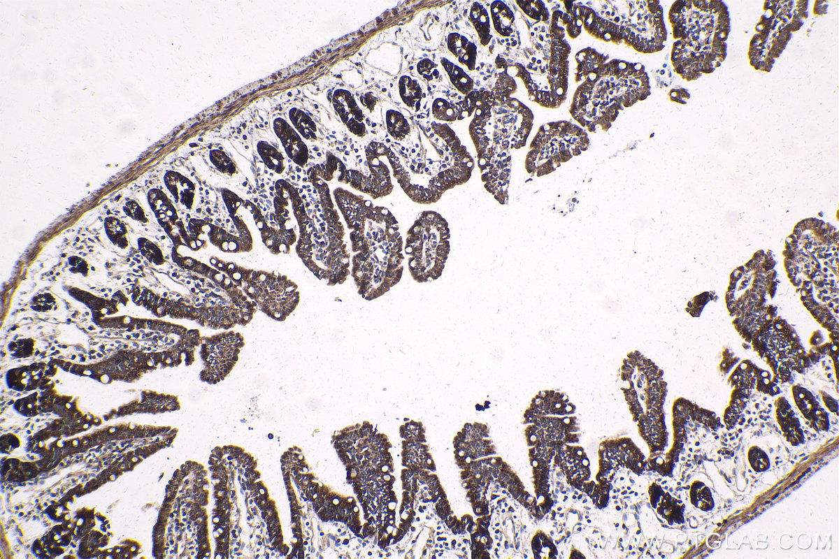 Immunohistochemical analysis of paraffin-embedded mouse small intestine tissue slide using KHC1807 (SETD3 IHC Kit).