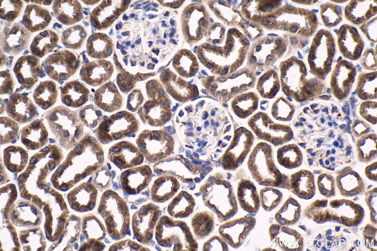 Immunohistochemical analysis of paraffin-embedded mouse kidney tissue slide using KHC1807 (SETD3 IHC Kit).