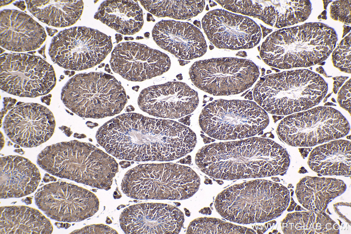 Immunohistochemical analysis of paraffin-embedded mouse testis tissue slide using KHC1807 (SETD3 IHC Kit).