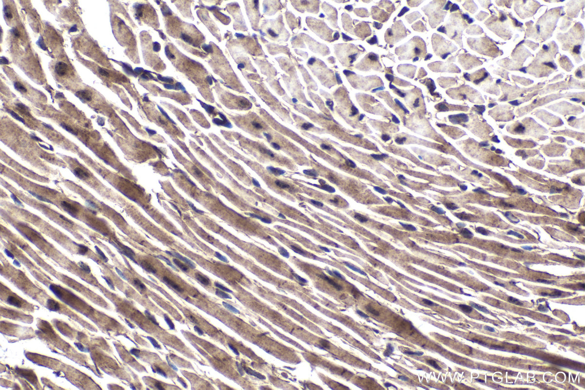 Immunohistochemical analysis of paraffin-embedded mouse heart tissue slide using KHC1801 (SETX IHC Kit).