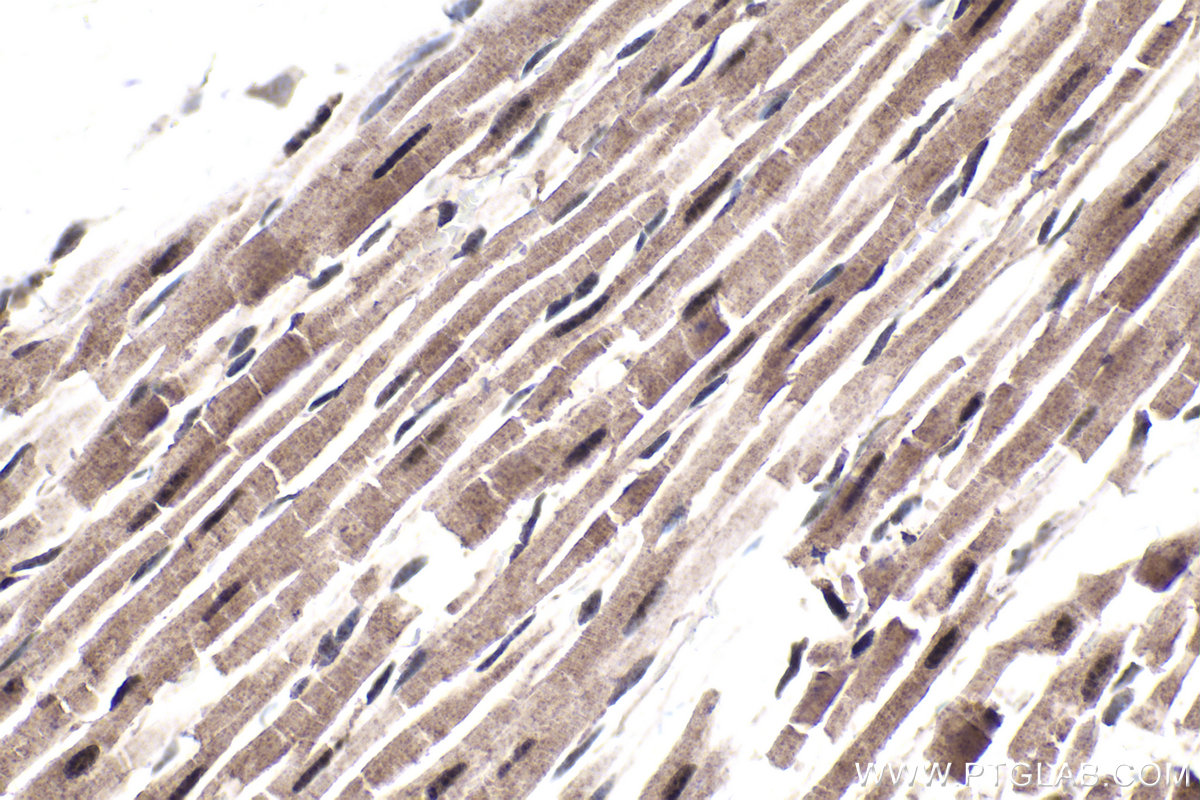 Immunohistochemical analysis of paraffin-embedded rat heart tissue slide using KHC1801 (SETX IHC Kit).